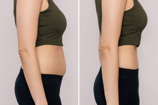 WEIGHT LOSS